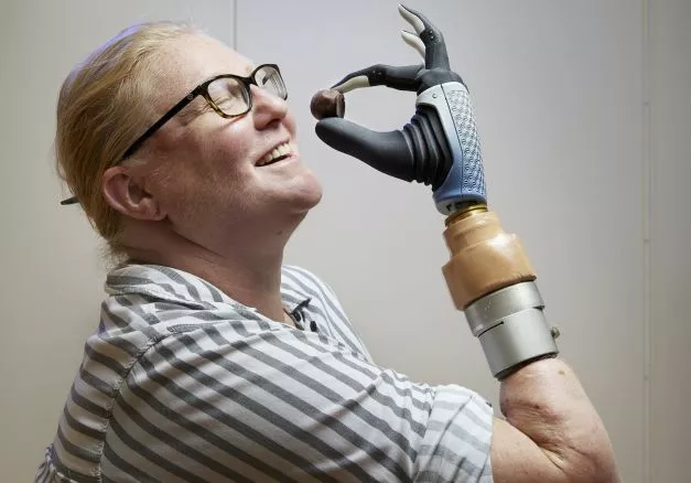 Бионическую руку прикрепили к скелету и подключили к нервной системе Она позволяет ощущать обратную связь