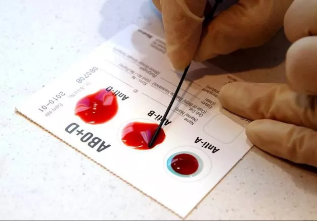 Создан экспресс-тест для определения группы крови Его разработали в Новосибирске